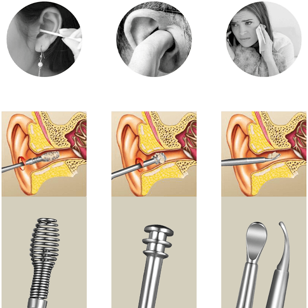 Ear cleaning set – Kit pulizia orecchie 03